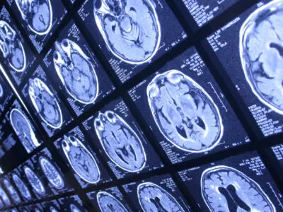 several x-rays of the brain