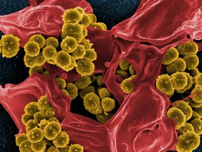 yellow bacteria in the bloodstream