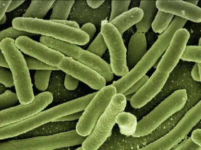 koli bacteria under a microscope