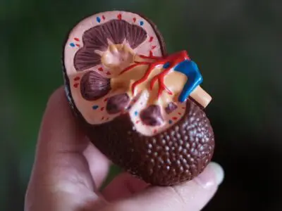 3D model of kidney