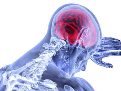 colorful x-ray scan of brain