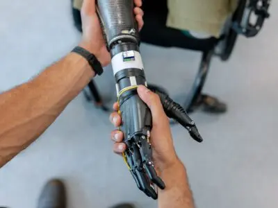 amputee with a prosthetic arm