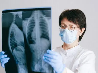 doctor examining chest and body x-rays