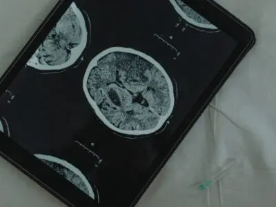brain scan x-ray